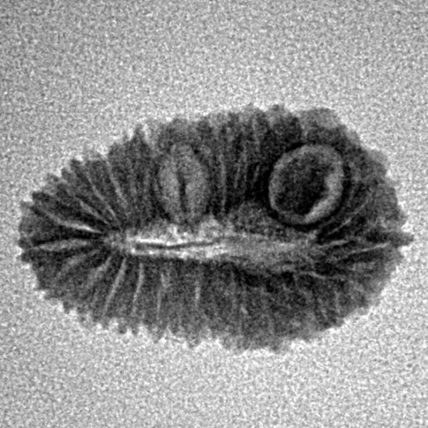 27 Mukhi Rudraksha 19.8mm 1.19gm - Inverse xray