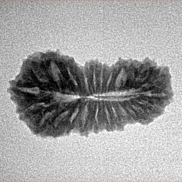 25 Mukhi Rudraksha 23.3mm 1.71gm - Inverse xray
