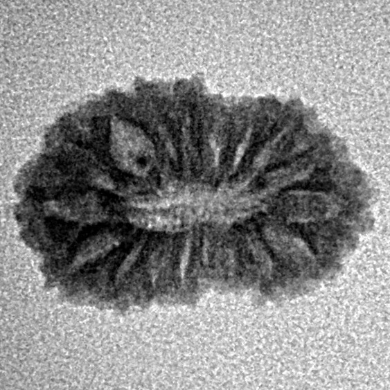 17 Mukhi Rudraksha 17.5mm 0.95gm - Inverse xray