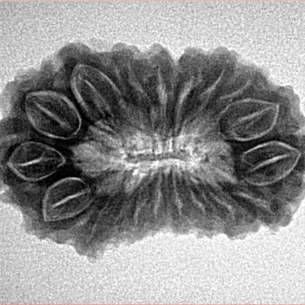 19 Mukhi Rudraksha 27.7mm 3.72gm - Inverse xray
