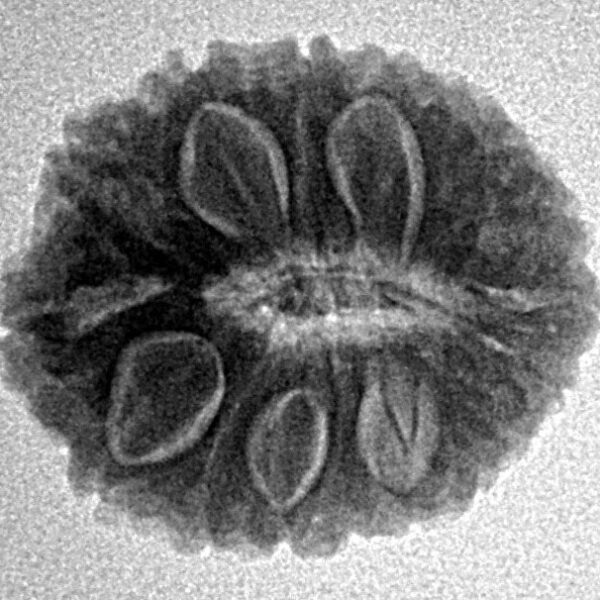 18 Mukhi Rudraksha 19.8mm 2.63gm - Inverse xray