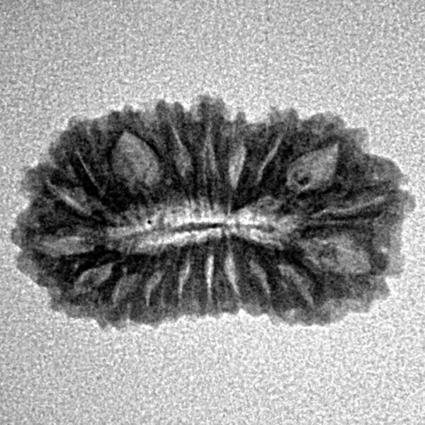 19 Mukhi Rudraksha 22.1mm 1.7gm - Inverse xray