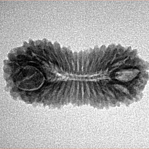 30 Mukhi Rudraksha 25mm 1.85gm - Inverse xray