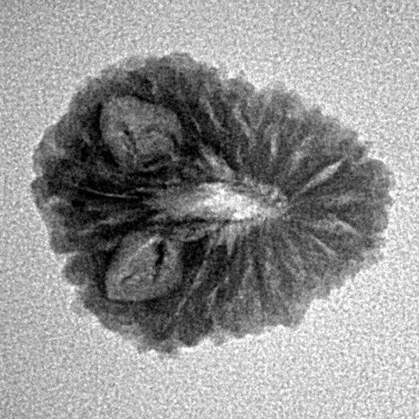 16 Mukhi Rudraksha 20.3mm 1.73gm - Inverse xray