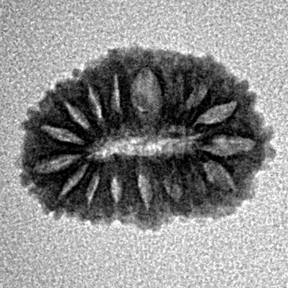 17 Mukhi Rudraksha 16.6mm 1.1gm - Inverse xray