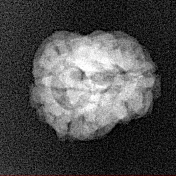 2 Mukhi Rudraksha 20.3mm 1.42gm - Xray