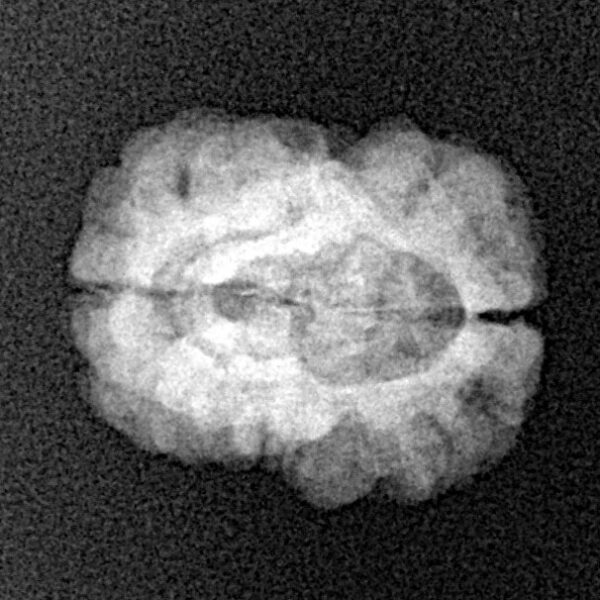 2 Mukhi Rudraksha 22.3mm 1.78gm - Xray