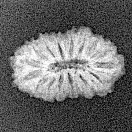 16 Mukhi Rudraksha 16.2mm 0.88gm - Xray