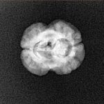 2 Mukhi Rudraksha 20.3mm 1.62gm - Xray