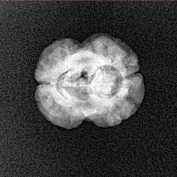 2 Mukhi Rudraksha 20.3mm 1.62gm - Xray