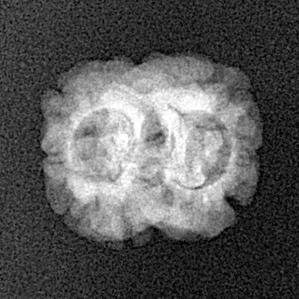 2 Mukhi Rudraksha 19.5mm 1.45gm - Xray