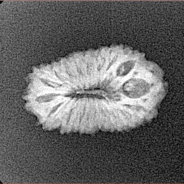 19 Mukhi Rudraksha 20mm 1.51gm - Origin: Indonesia - Xray