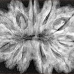 12 Mukhi Rudraksha 36.2mm 7.73gm - Xray