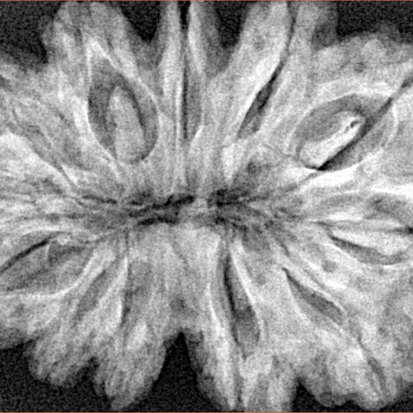 12 Mukhi Rudraksha 36.2mm 7.73gm - Xray