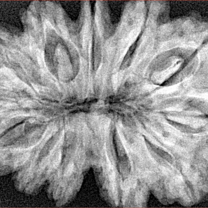 12 Mukhi Rudraksha 36.2mm 7.73gm - Xray