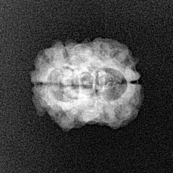 2 Mukhi Rudraksha 22.5mm 1.54gm - Xray