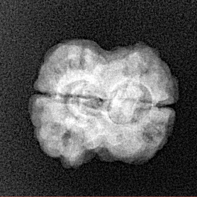 2 Mukhi Rudraksha 22.2mm 2.2gm - Xray