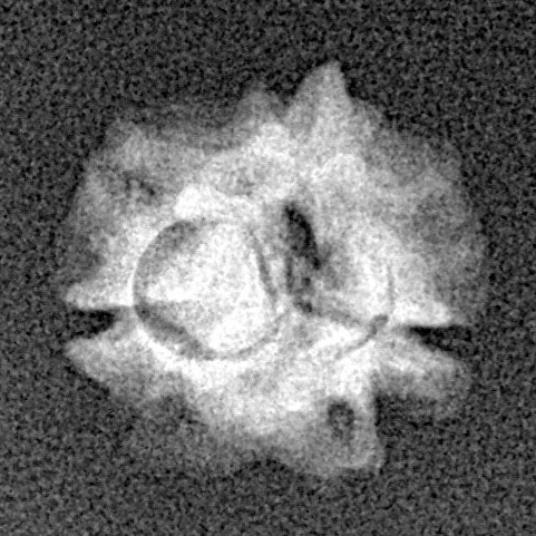 2 Mukhi Rudraksha 15mm 0.86gm - Xray