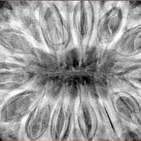 14 Mukhi Rudraksha 40.4mm 12gm - Xray