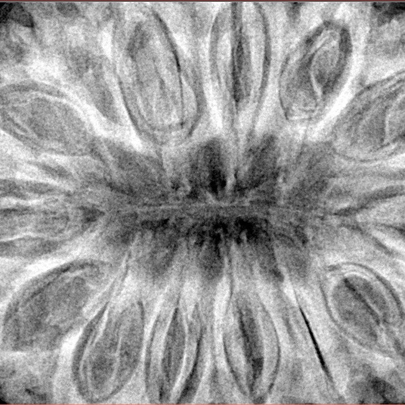 14 Mukhi Rudraksha 40.4mm 12gm - Xray