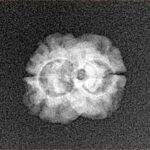 2 Mukhi Rudraksha 15.4mm 1.06gm - Xray