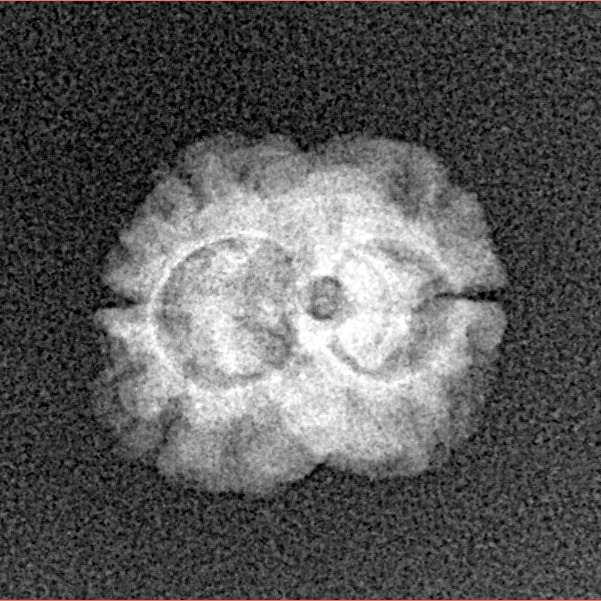 2 Mukhi Rudraksha 15.4mm 1.06gm - Xray