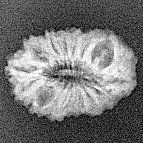 16 Mukhi Rudraksha 18.3mm 1gm - Xray