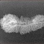 35 Mukhi Rudraksha 27.3mm 0.98gm - Xray