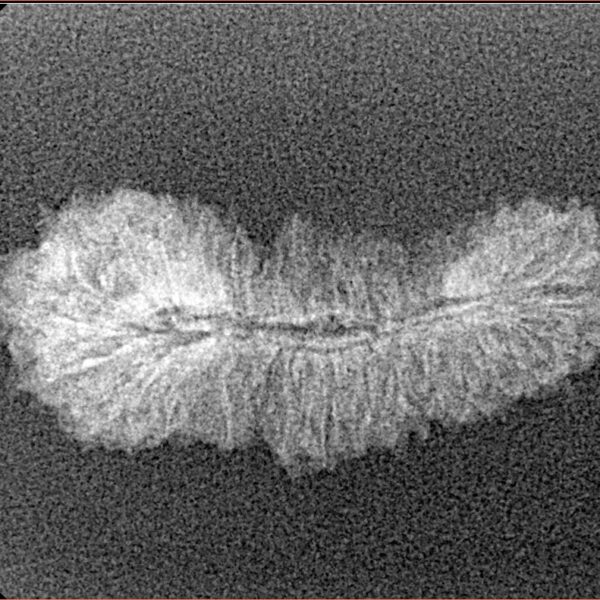 35 Mukhi Rudraksha 27.3mm 0.98gm - Xray