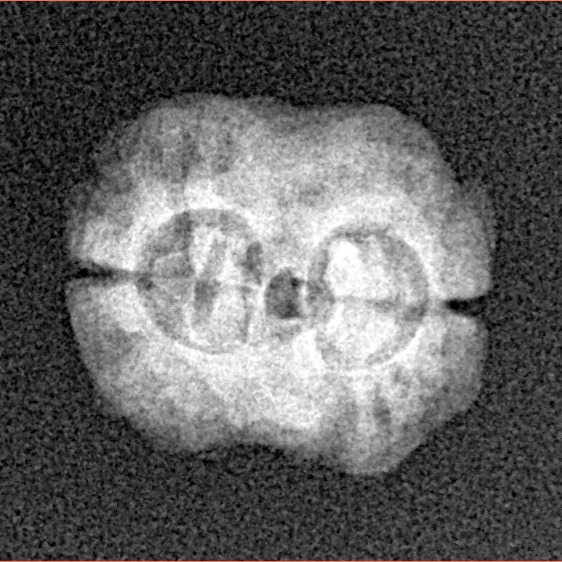 2 Mukhi Rudraksha 18.4mm 1.45gm - Xray
