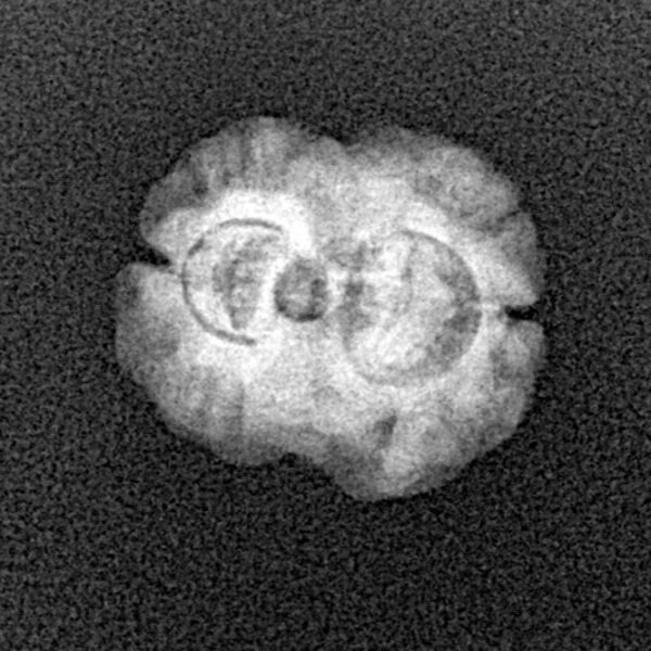 2 Mukhi Rudraksha 18.4mm 1.39gm - Xray