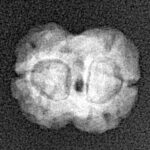 2 Mukhi Rudraksha 17.7mm 1.33gm - Xray