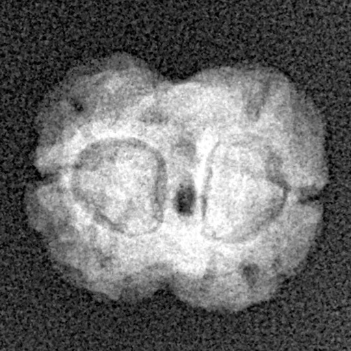 2 Mukhi Rudraksha 17.7mm 1.33gm - Xray