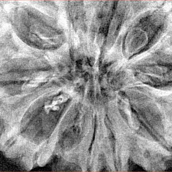 11 Mukhi Rudraksha 36.2mm 8.28gm - Xray