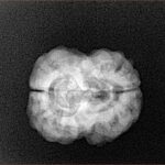 2 Mukhi Rudraksha 23.8mm 2.84gm - Xray