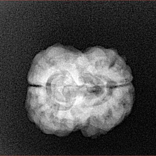 2 Mukhi Rudraksha 23.8mm 2.84gm - Xray