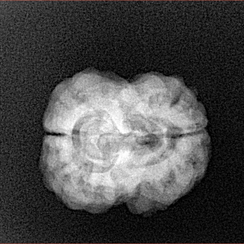 2 Mukhi Rudraksha 23.8mm 2.84gm - Xray