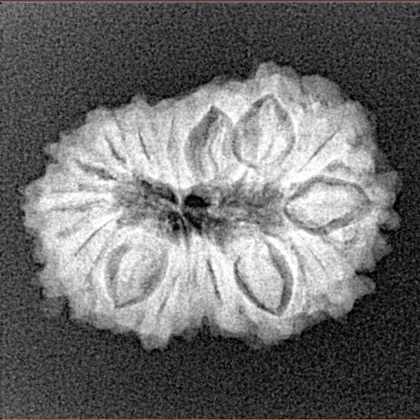 16 Mukhi Rudraksha 23.1mm 2.8gm - Xray