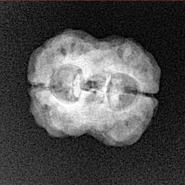 2 Mukhi Rudraksha 23.6mm 2.29gm - Xray