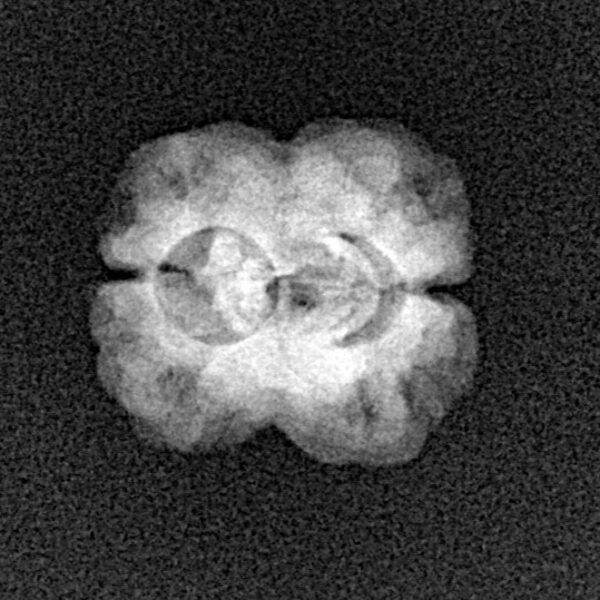 2 Mukhi Rudraksha 21.3mm 1.43gm - Xray