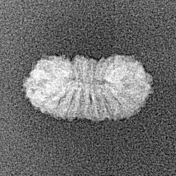 20 Mukhi Rudraksha 16mm 0.42gm - Xray