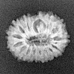 15 Mukhi Rudraksha 17.1mm 1.3gm - Xray