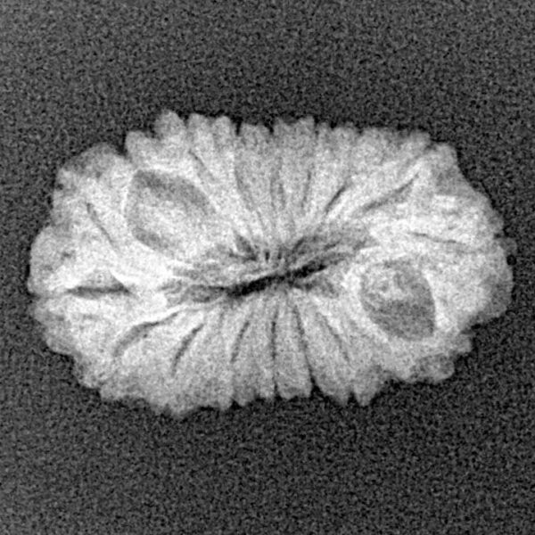 17 Mukhi Rudraksha 21.2mm 1.64gm - Xray