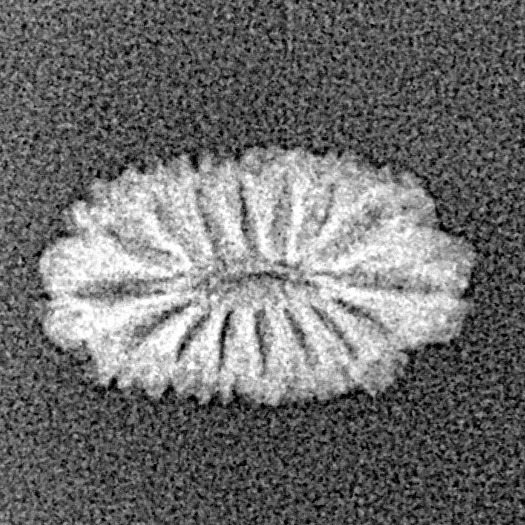 16 Mukhi Rudraksha 14.2mm 0.39gm - Xray