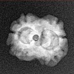 2 Mukhi Rudraksha 17.8mm 1.48gm - Origin: Nepal - Xray