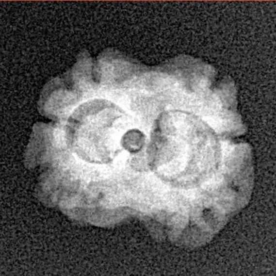 2 Mukhi Rudraksha 17.8mm 1.48gm - Origin: Nepal - Xray