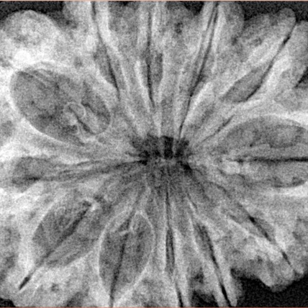 12 Mukhi Rudraksha 35.1mm 7.75gm - Xray