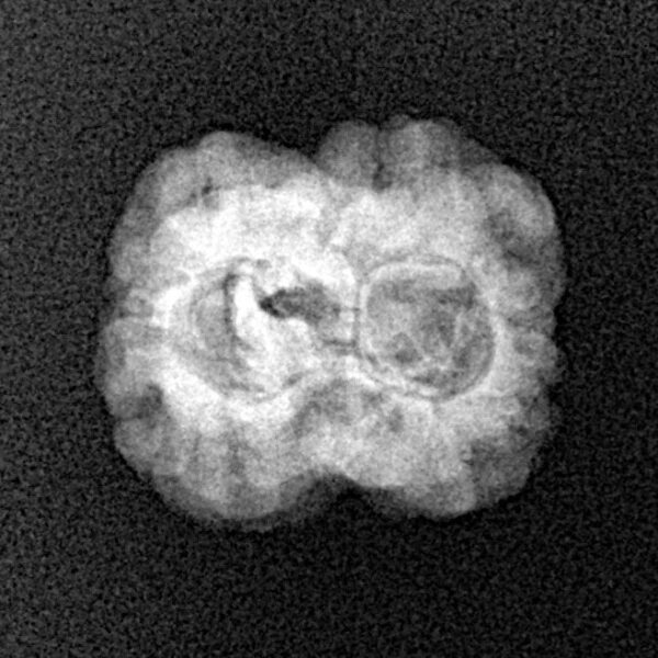 2 Mukhi Rudraksha 23mm 1.86gm - Xray