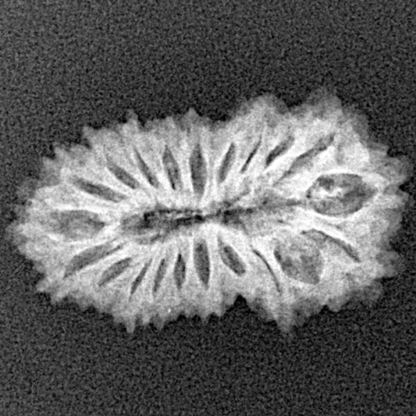 21 Mukhi Rudraksha 23.1mm 2gm - Xray
