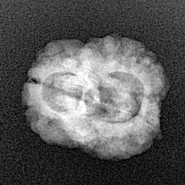 2 Mukhi Rudraksha 23.3mm 2gm - Xray